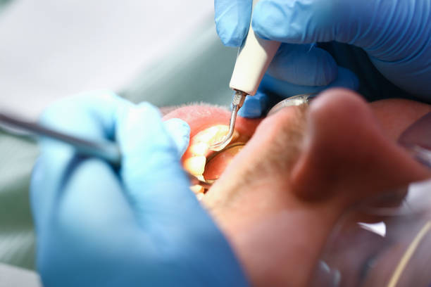 Best Emergency Dental Surgery in Pilot Mountain, NC